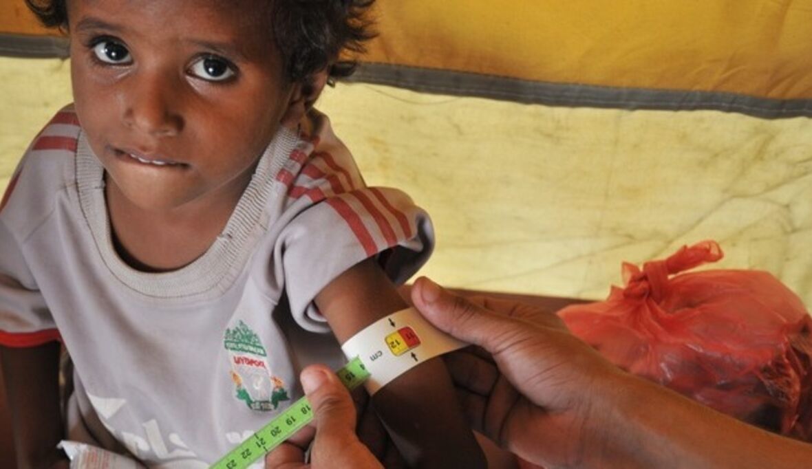 Millionen Menschen im Jemen von Hunger bedroht 