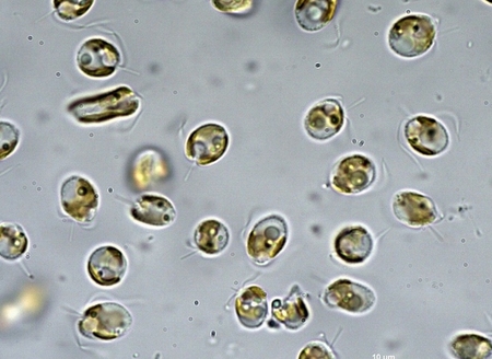 Die Goldalge Prymnesium parvum unter dem Mikroskop.