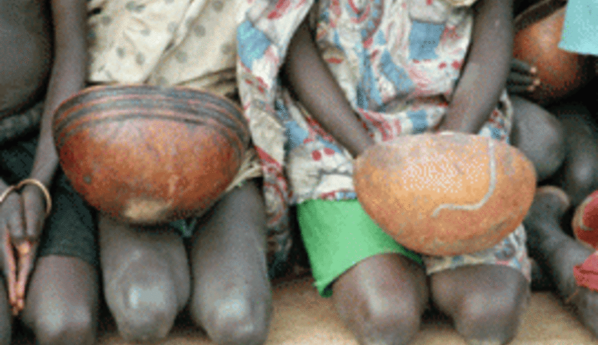 Warnung vor Nahrungskrise im Niger - frühzeitige Hilfe schützt Leben